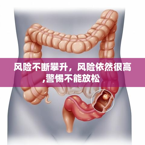风险不断攀升，风险依然很高,警惕不能放松 